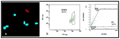 Evaluation of Sperm DNA Fragmentation Using Two Different Methods ...