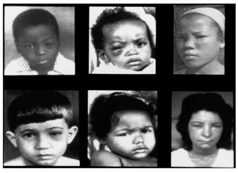 What Do You Need to Know before Studying Chagas Disease? A Beginner’s Guide