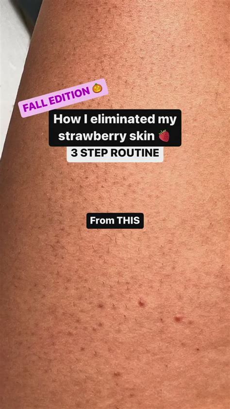 get rid of strawberry skin🛀🍓 en 2024