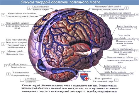 мозговой намет что это такое простыми словами