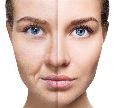 What having Bakuchiol ingredient in your Skincare means? | Femina.in