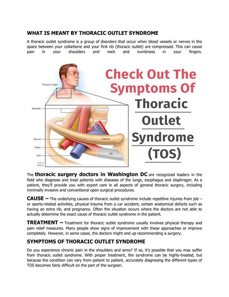 PPT - Check Out The Symptoms Of Thoracic Outlet Syndrome (TOS ...