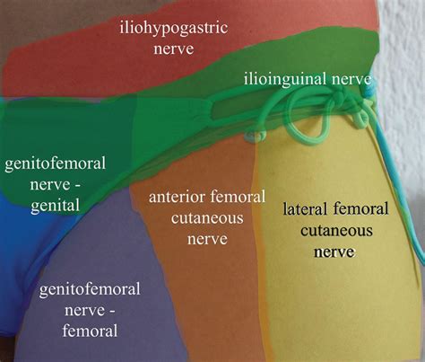 Ilioinguinal and Iliohypogastric Nerve - Clinical Tree