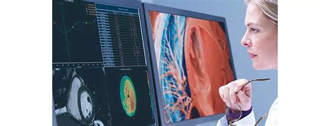 Advanced Visualization Workspace 15 | Philips