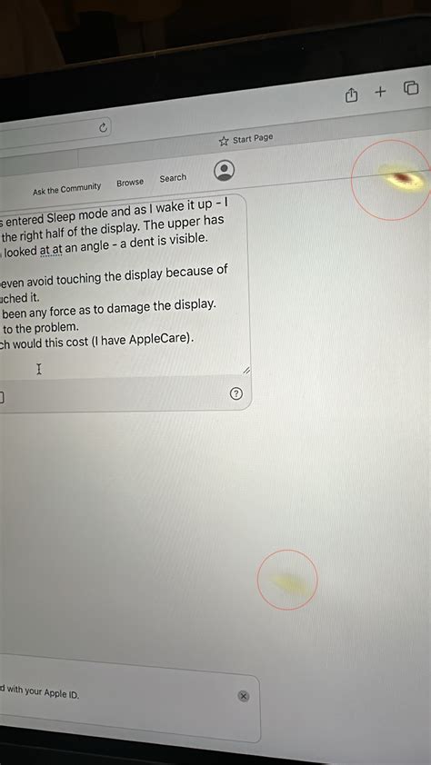 Yellow spots on the display of MacBook Ai… - Apple Community