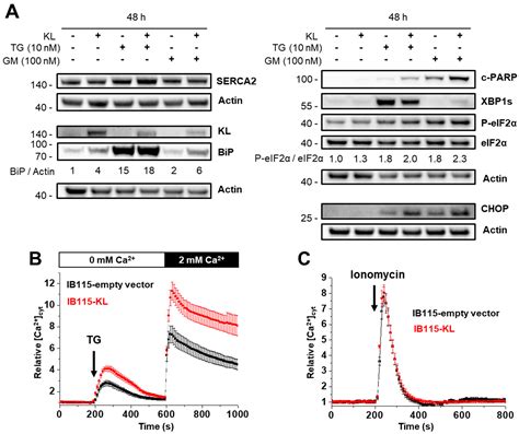 The Role of the Anti-Aging Protein Klotho in IGF-1 Signaling and ...