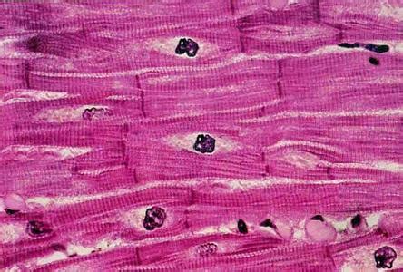 图册vrim7zjd:心肌营养障碍 - 搜狗百科图册n2d8e:心脏细胞切片图 (第