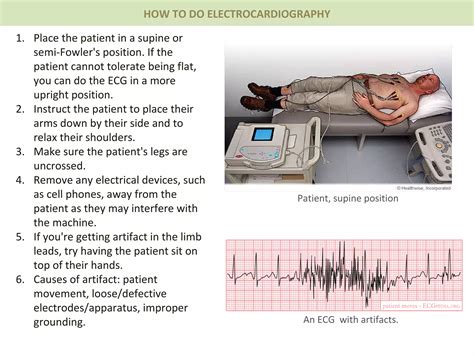 ecg.pdf