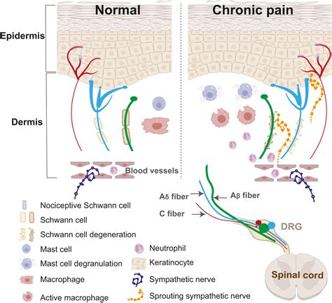 Peripheral mechanisms of chronic pain