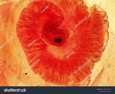 Tapeworm Removal Surgery at Gary Roof blog