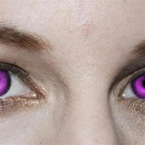 Purple Eye Syndrome