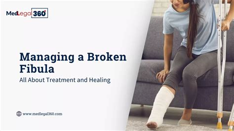 Managing a Broken Fibula: Know About Treatment and Healing