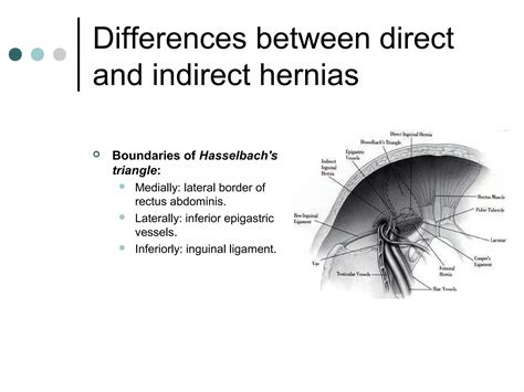 Hernia | PPT