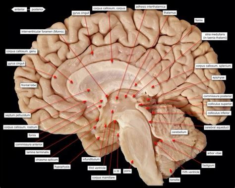 Labeled Brain Model - Bing Images | Brain anatomy, Brain models ...
