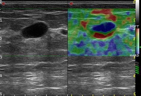 About|BEST-FETAL CARE|PALAKKAD|Sonography|Ultrasound Scan|Centre