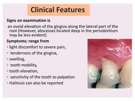 presentation abscess of the periodontium .pptx