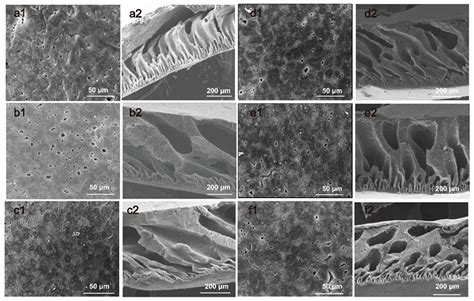 Temperature-Responsive Separation Membrane with High Antifouling ...