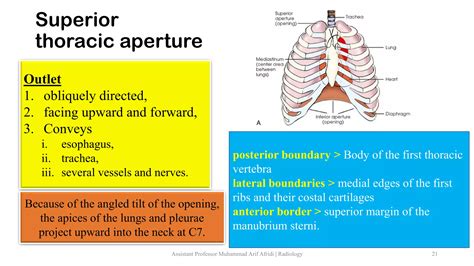 Anatomy of Thoracic Wall.pdf