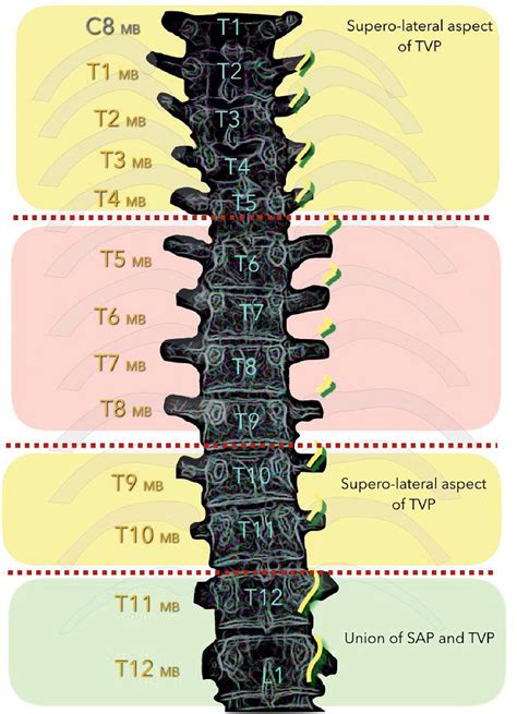 Facet Pain: Pathogenesis, Diagnosis, and Treatment - Clinical Tree