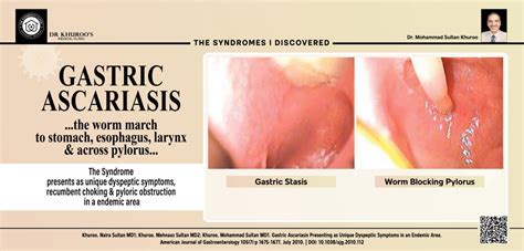 Prof. M. S. Khuroo, MD, DM, FRCP, FACP, MACP (Emeritus), Director ...