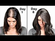 Thick Vs Thin Hair by She Had Thin Hair She Used This Got Thick Hair In Thick Vs Thin Hair