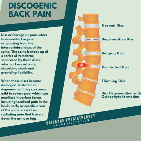 Discogenic Disease Symptoms
