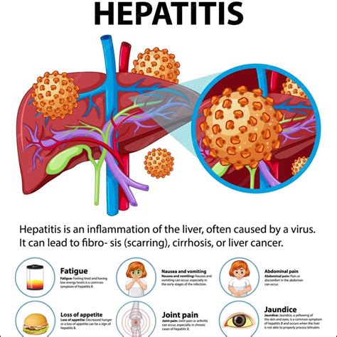 Hepatitis B Treatment News - EMSEKFLOL.COM