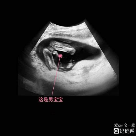 16周胎儿性别图对比-图库-五毛网