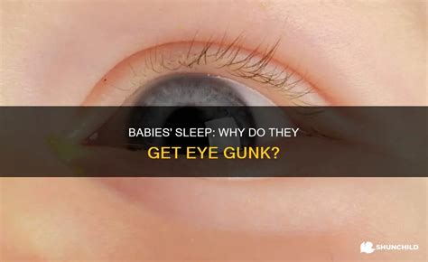 Babies' Sleep: Why Do They Get Eye Gunk? | ShunChild