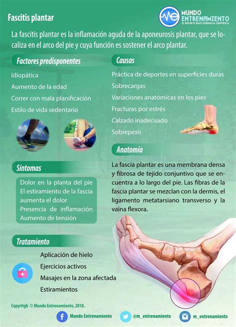 Fascitis plantar: causas y tratamiento | Mundo Entrenamiento
