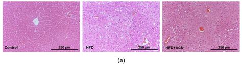 Preventive Effects of Anthocyanins from Lyciumruthenicum Murray in High ...