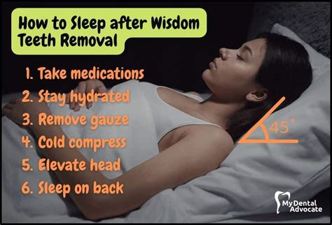 Sleeping Too Much After Surgery at Elaine Osborn blog