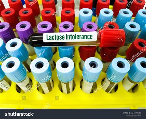 46 Lactase Enzyme Concept Images, Stock Photos & Vectors | Shutterstock