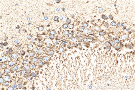 Sortilin antibody (12369-1-AP) | Proteintech