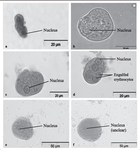 Entamoeba Histolytica Trophozoite - sketch of entamoeba histolytica