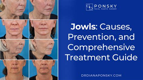 Jowls: Causes, Prevention, and Comprehensive Treatment Guide