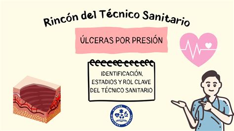 Úlceras por Presión: Todo lo que tienes que saber.