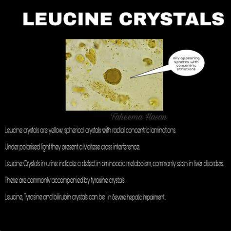 Leucine In Urine