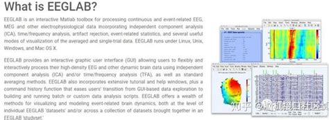 EEG MATLAB Load File 的图像结果