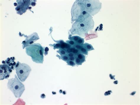 Pathology Outlines - Normal and nonneoplastic findings