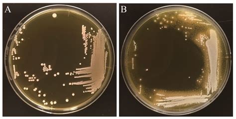 Identification of Bile Salt Hydrolase and Bile Salt Resistance in a ...