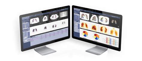 NM/CT 850 | GE HealthCare (India)