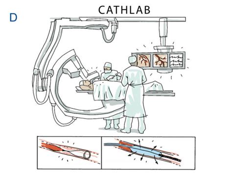 Image result for Cath Lab RN