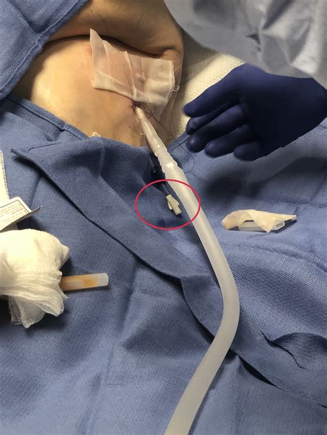 Chest Tube Instrument