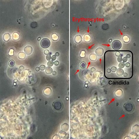 Yeast Slide Microscope