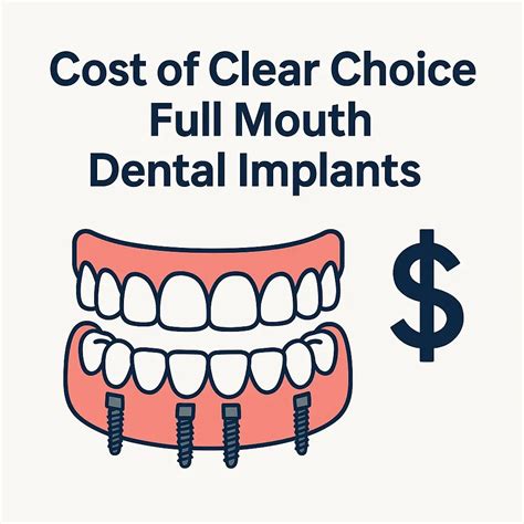Cost of Clear Choice Full Mouth Dental Implants: A Complete Guide
