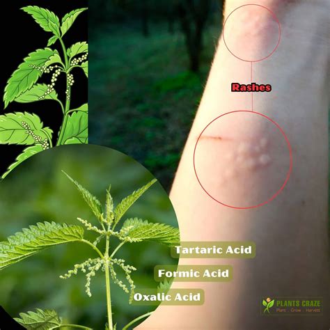 What Do Stinging Nettle Roots Look Like at Terry Summers blog