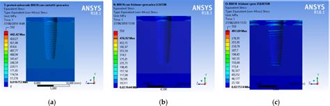 FEM Analysis of Dental Implant-Abutment Interface Overdenture ...