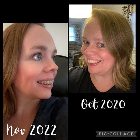 I Got Braces at 60 Years Old, and My Smile’s Never Looked Better Vector Art