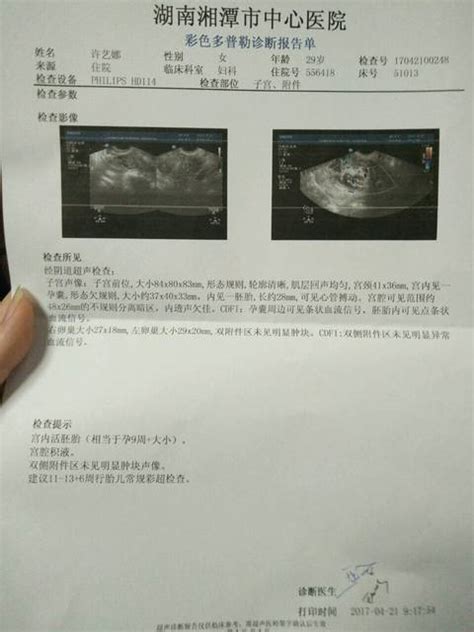 孕6周+4天，记第一次阴道彩超检查，宝宝像花生豆大！ - 百度宝宝知道